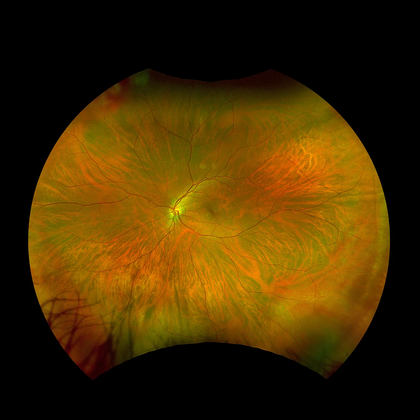 optomap couleur rg