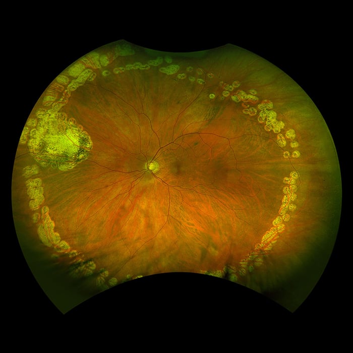 MonacoPro optomap couleur rg