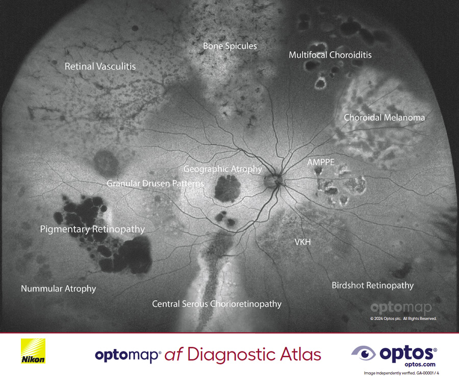 optomap af diagnostic atlas